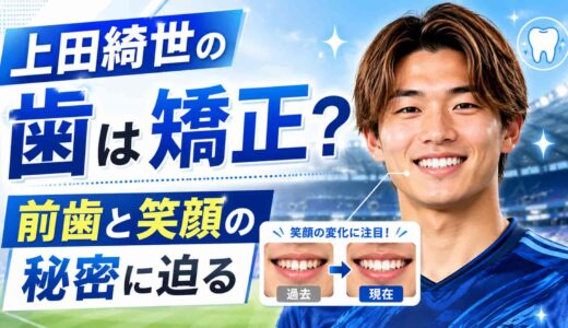 上田綺世の歯は矯正?前歯と笑顔の秘密に迫る