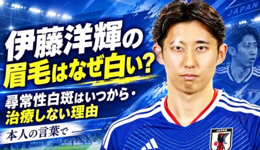 伊藤洋輝の眉毛はなぜ白い？尋常性白斑はいつから・治療しない理由を本人の言葉で